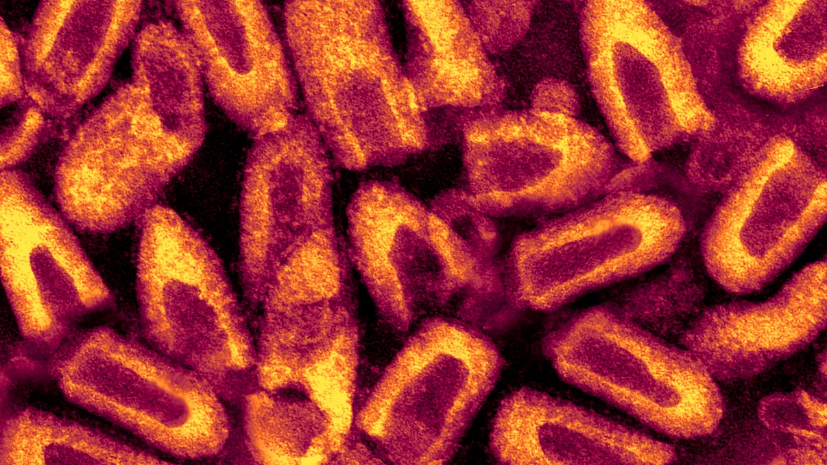 Boala care a inspirat zombii din World War Z revine în Franța la un deceniu după eradicare