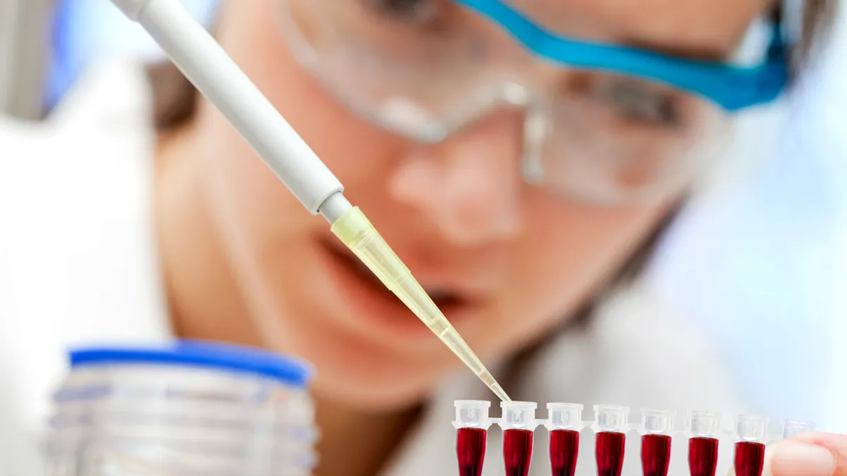 Testul care identifică cancerul dintr-o picătură de sânge