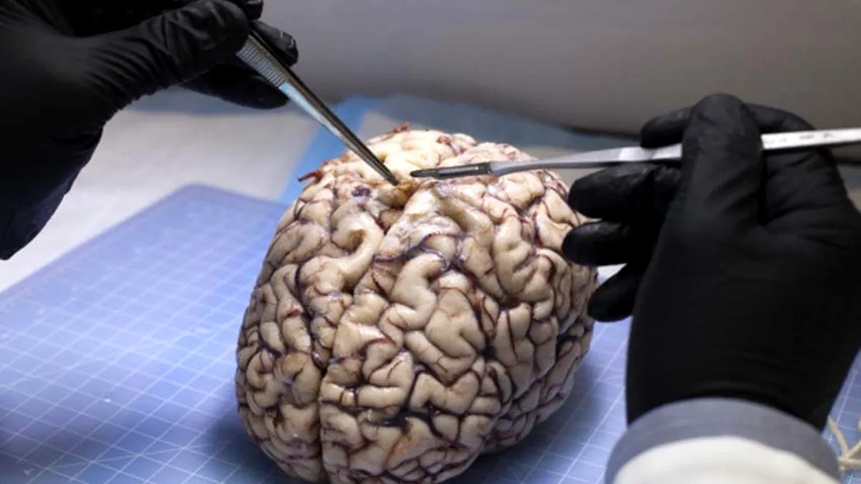 O nouă descoperire arată cum creierul e conectat la sistemul imunitar