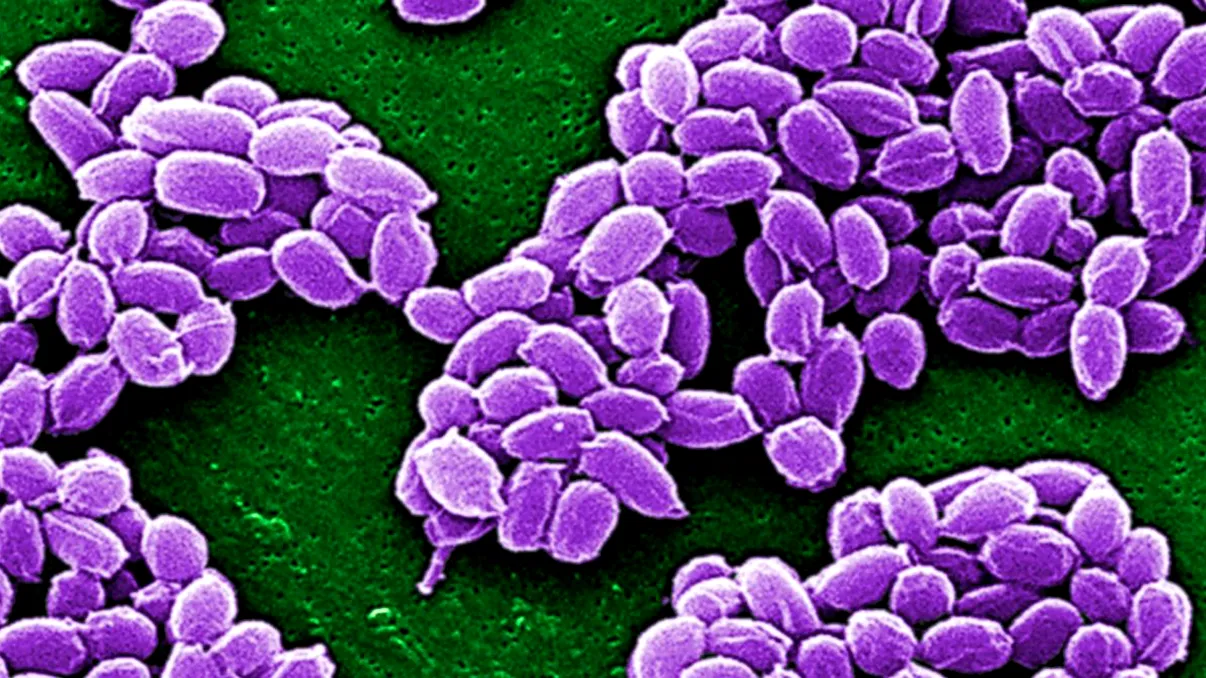 Epidemia de antrax din Siberia ar fi cauzată de încălzirea globală