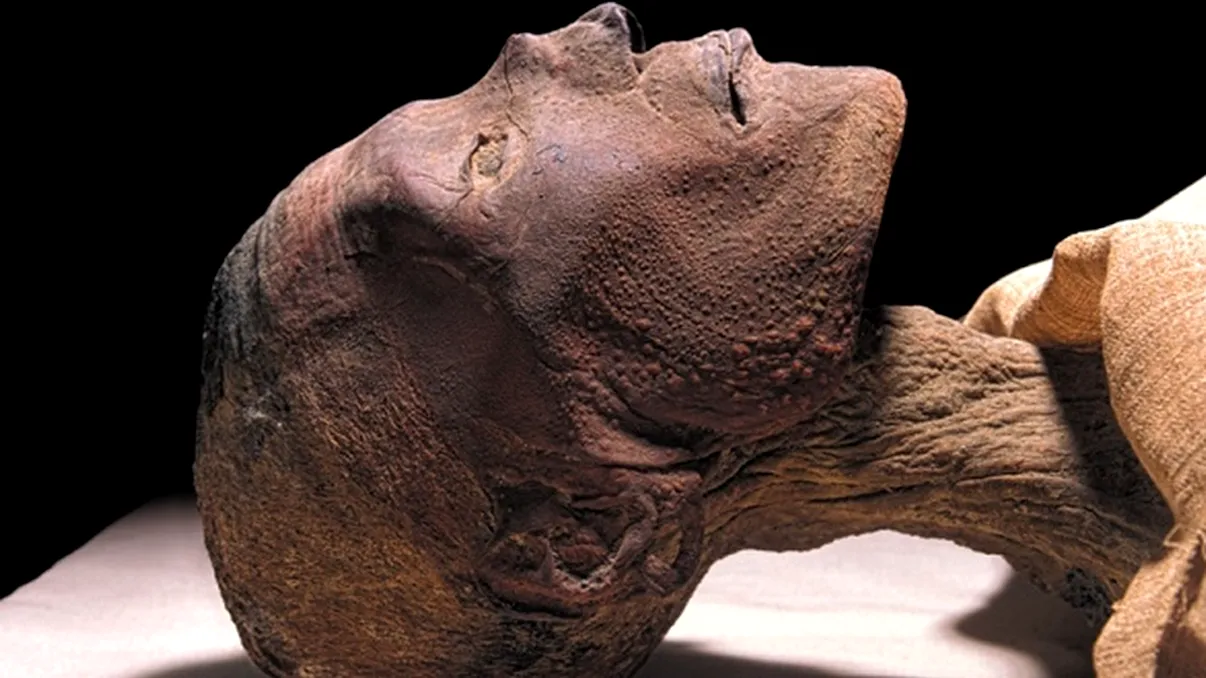 Una dintre cele mai periculoase boli ale omenirii ar putea reveni