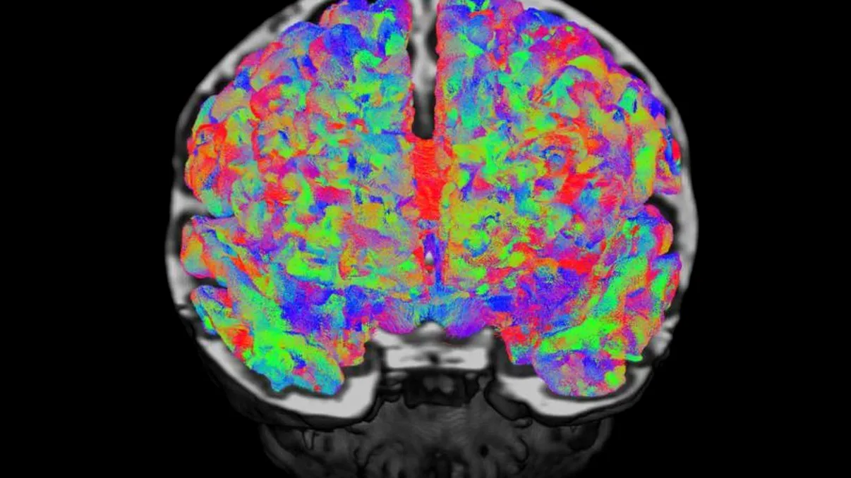 Cum îi ajută torrentele pe cercetători să studieze creierul bebelușilor