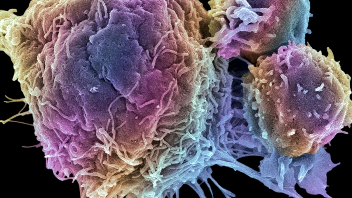 Cum vrea Microsoft să vindece cancerul cu ajutorul inteligenței artificiale