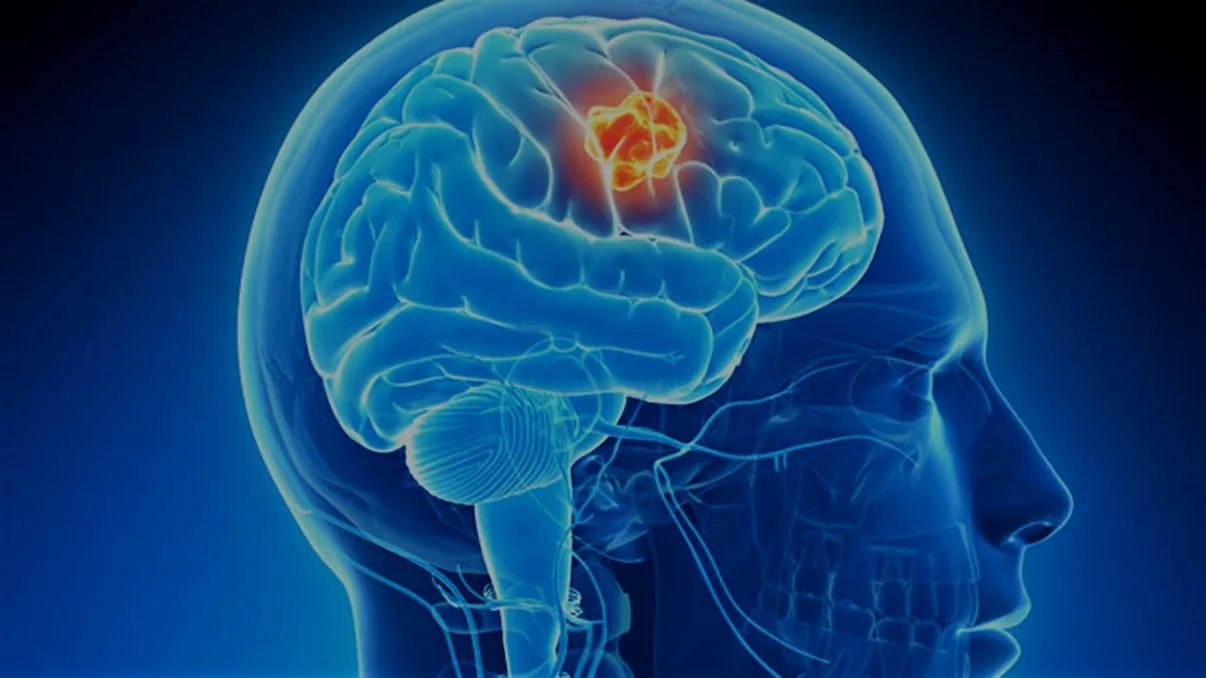 Virusul care salvează viețile bolnavilor care suferă de această afecțiune