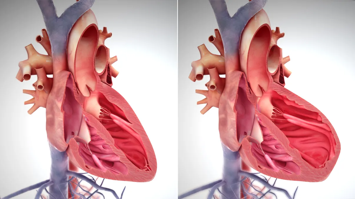 Capacul de toaletă care îți arată dacă suferi de o boală de inimă