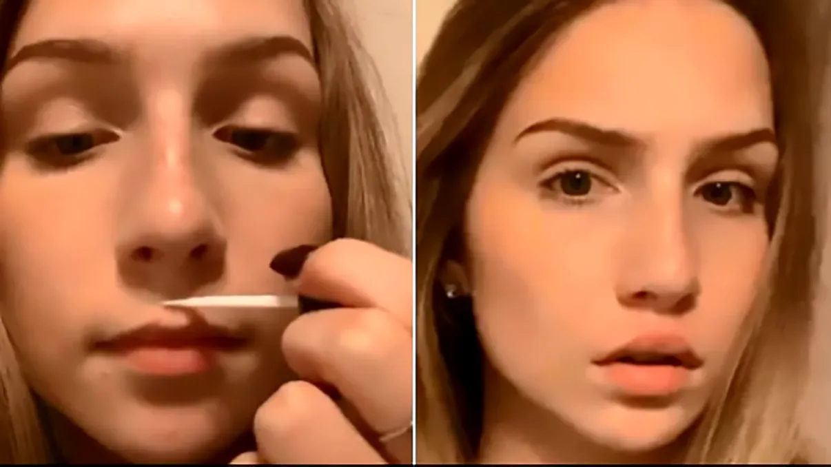 Cea mai ciudată provocare din online implică Super Glue și îți face buzele mai mari