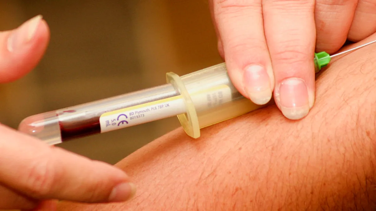 Tratamentul revoluționar care poate salva sute de mii de vieți. De ce li se ia sânge celor infectați cu virusul?