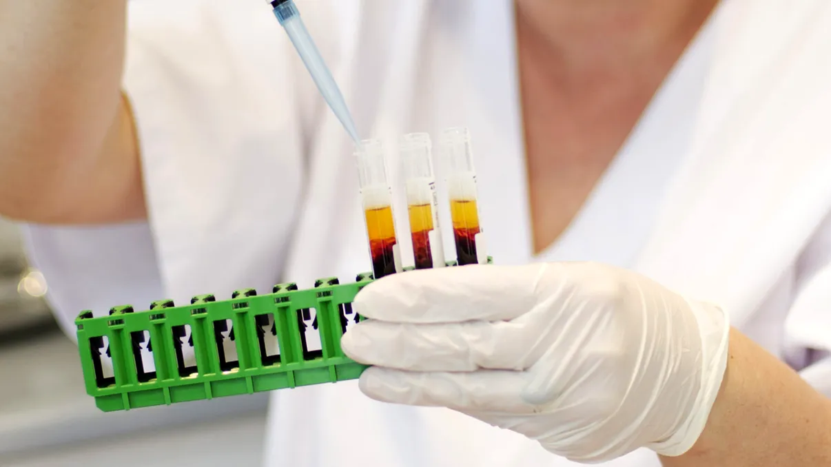 Românii dau lovitura în Europa: procedura medicală miraculoasă care poate salva mii de vieți