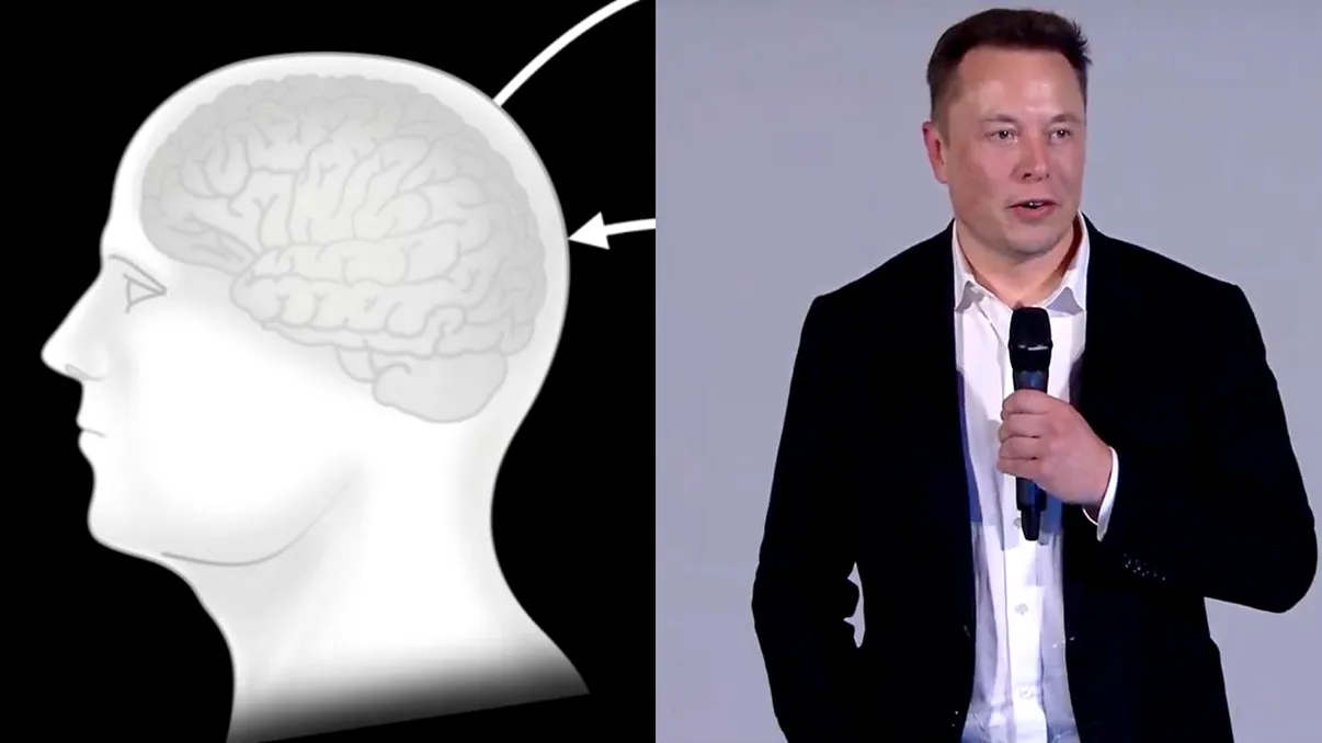 Cel mai așteptat anunț al lui Elon Musk: ne conectăm sau nu creierul la computere?