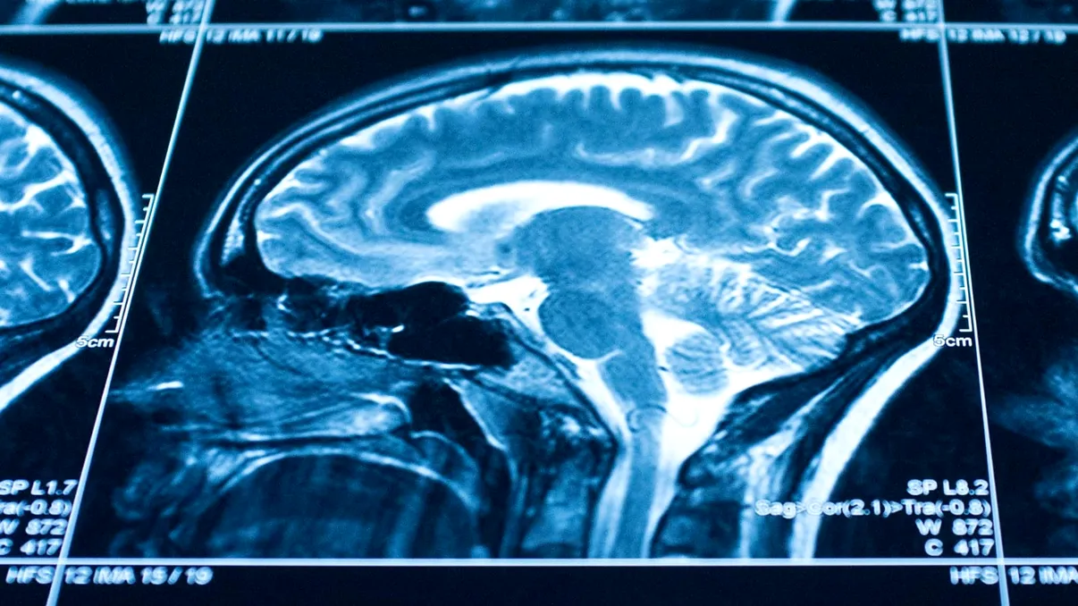 Tehnica de scanare cu raze X care ar putea arăta cum se formează gândurile