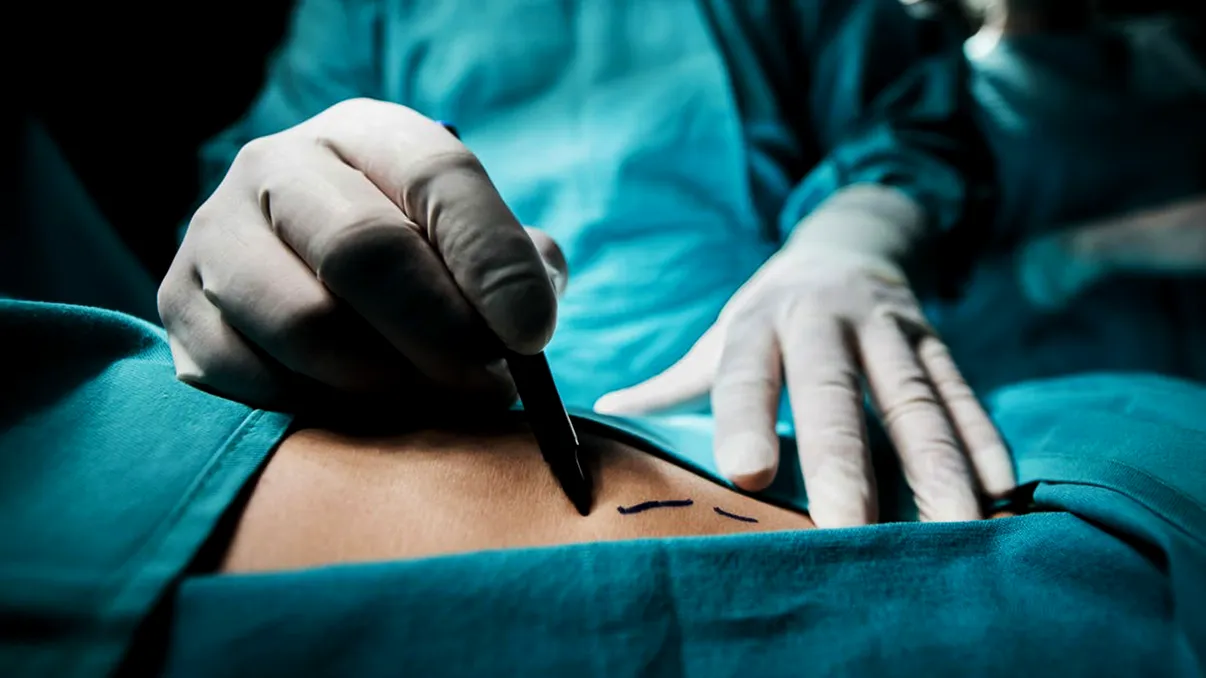 Metoda revoluționară prin care medicii speră să distrugă tumorile