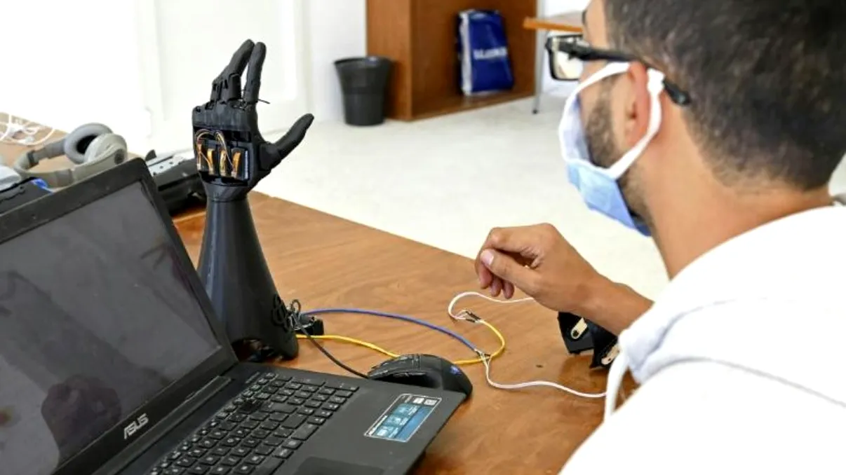 Aceste brațe bionice sunt printate 3D și alimentate cu energie solară