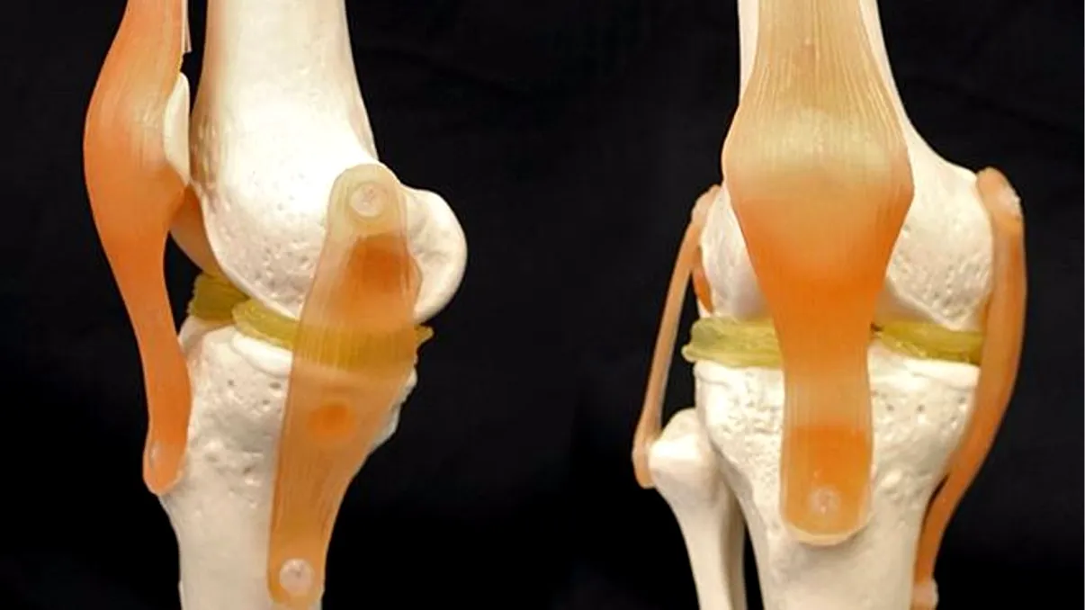 Tehnica prin care reumatismul ar putea deveni istorie: cum funcționează aceste cartilaje printate 3D