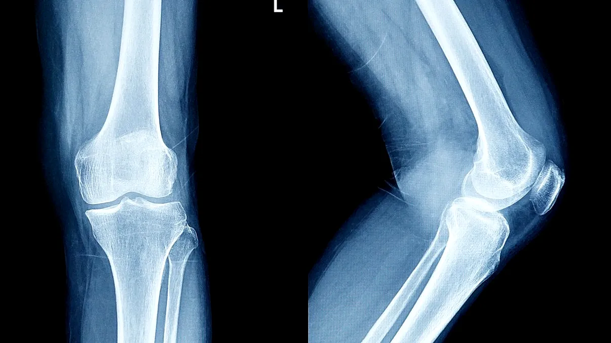 Cea mai bizară revoluție pentru baterii: cum sunt folosite oasele pentru reinventarea tehnologiei