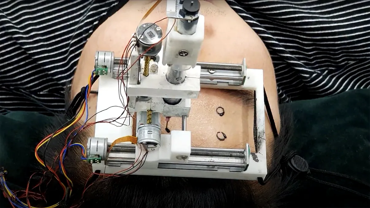 Acest startup vrea să-ți tatueze pe craniu electrozi care-ți citesc mintea. La ce ajută această tehnologie inovatoare