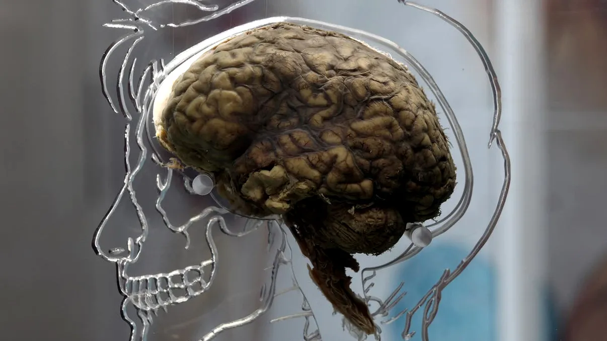 Ce se întâmplă cu creierul uman imediat după deces. Viața de după moarte, o realitate