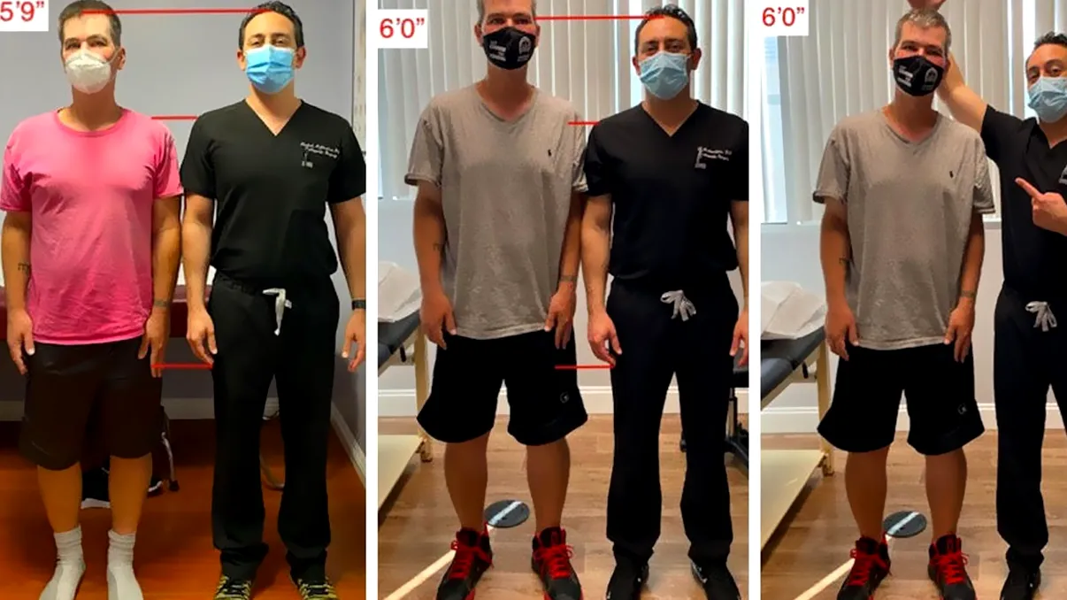 Bărbații care își rup picioarele și dau sute de mii de euro pentru asta. Ce scop vor să atingă aceștia