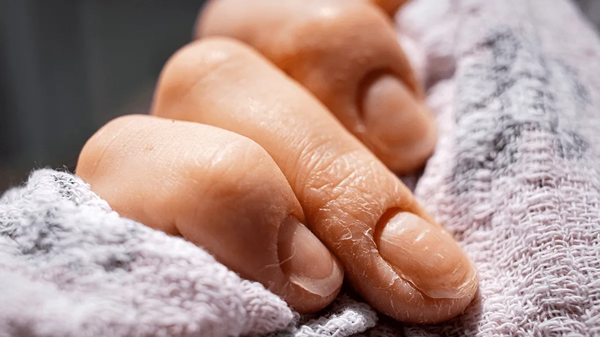 De ce se uită doctorul la unghiile tale și cum își dă seama, ca prin „minune”, ce boli ai