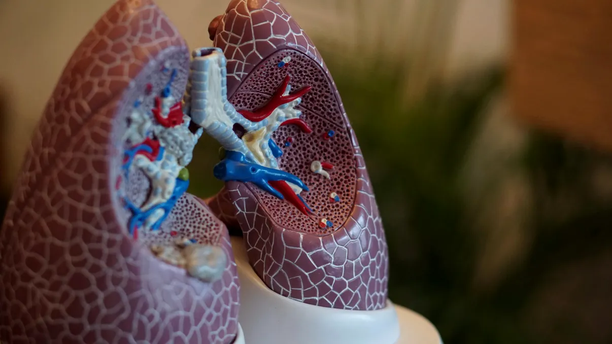 Un nou instrument AI poate detecta cancerul pulmonar mai bine decât orice metodă existentă
