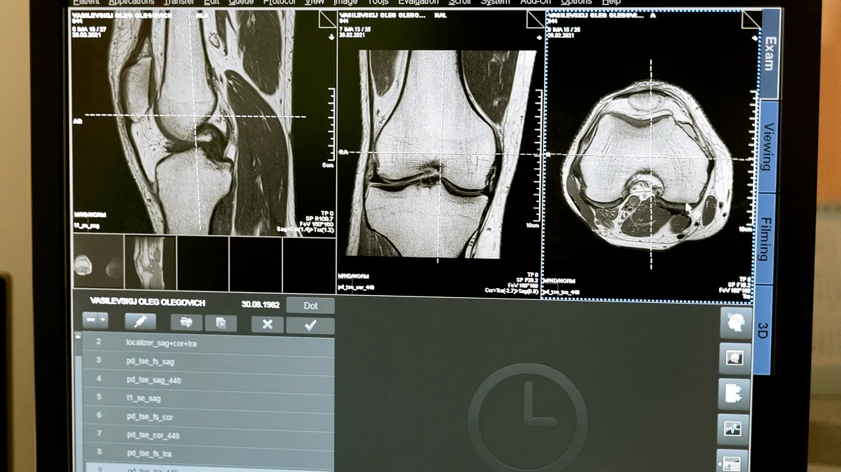Aproape 45% dintre oameni nu au acest os în corp. Care este explicația oamenilor de știință