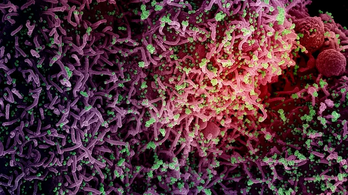 Care a fost primul virus descoperit din istorie. Când s-a întâmplat acest lucru, ce boală producea