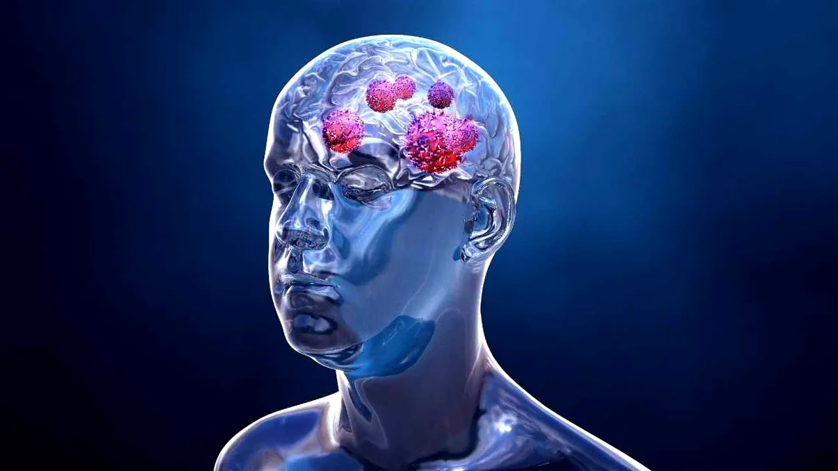 Oamenii de știință ar fi descoperit leacul pentru cancerul cerebral. Cât de repede te poți vindeca, de fapt