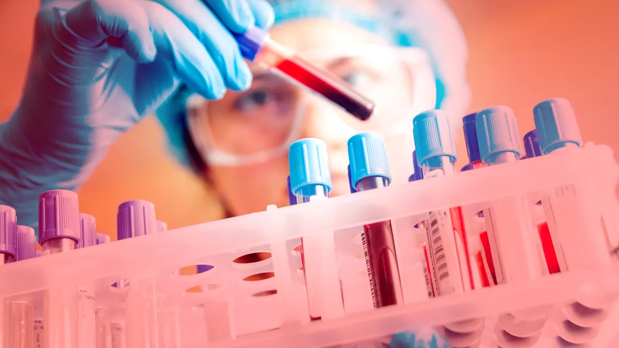 Ce să nu faci înainte de analizele medicale pentru a asigura acuratețea rezultatelor