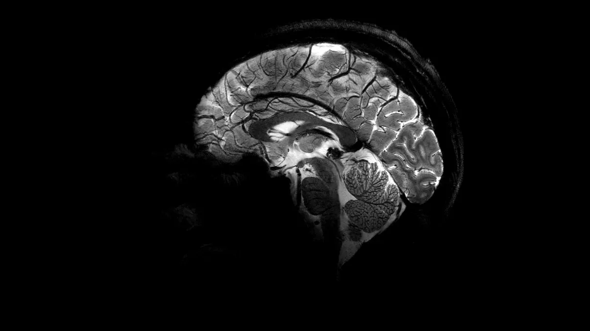 Premieră în medicină: Primul implant cranian transparent deschide o 