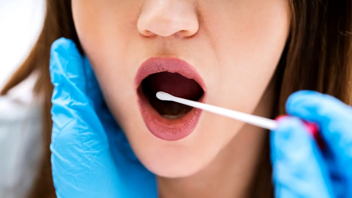 O bacterie din cavitatea bucală poate „topi” anumite tipuri de cancer, conform unui studiu