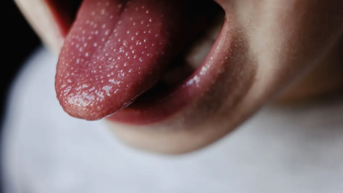 Culoarea limbii tale îți poate dezvălui starea de sănătate: Ce au descoperit oamenii de știință