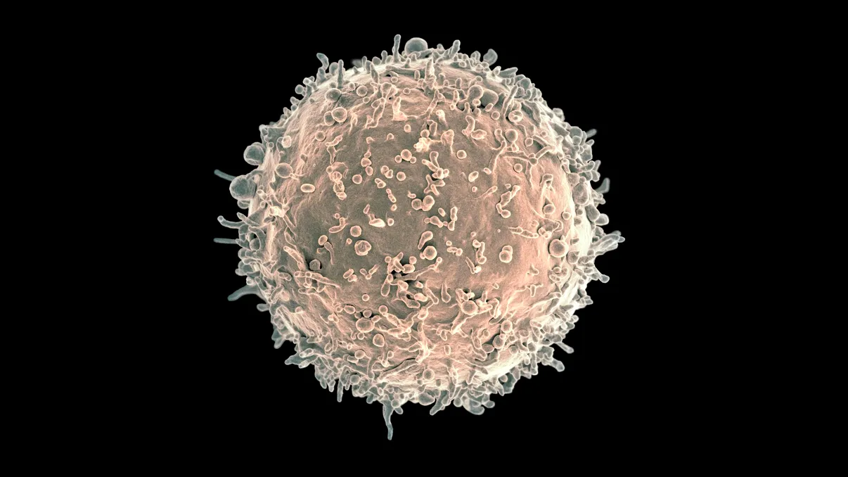 Leucemia a fost tratată cu celule modificate genetic în România: Ce spun specialiștii despre premiera medicală