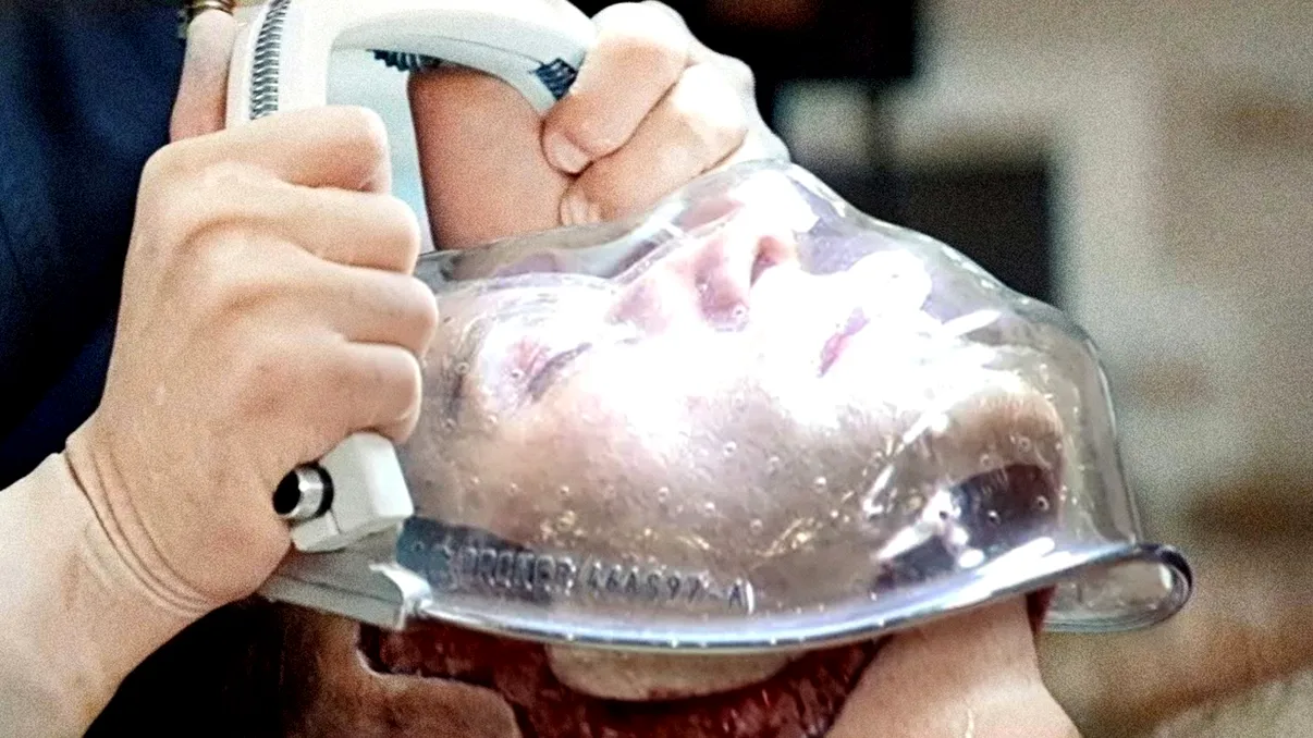 Cum arată bărbatul care a primit o nouă față și o nouă viață: transplantul facial, un adevărat 
