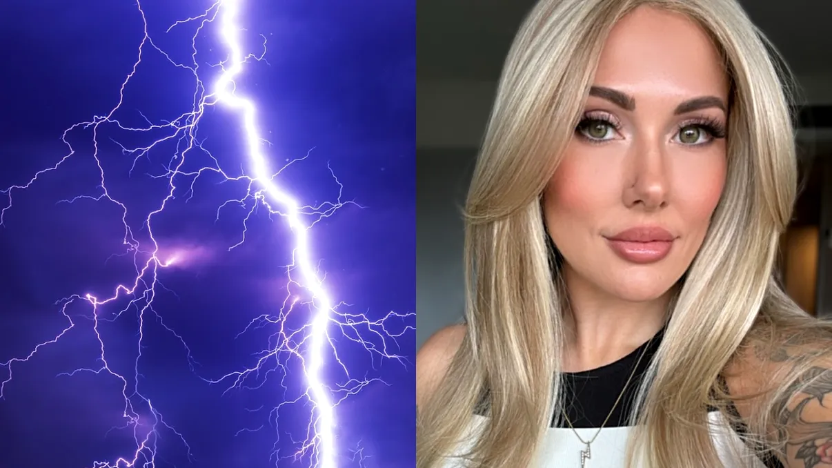 Lovită de un fulger, a fost paralizată ore întregi şi a rămas cu un ochi de culoare diferită. 