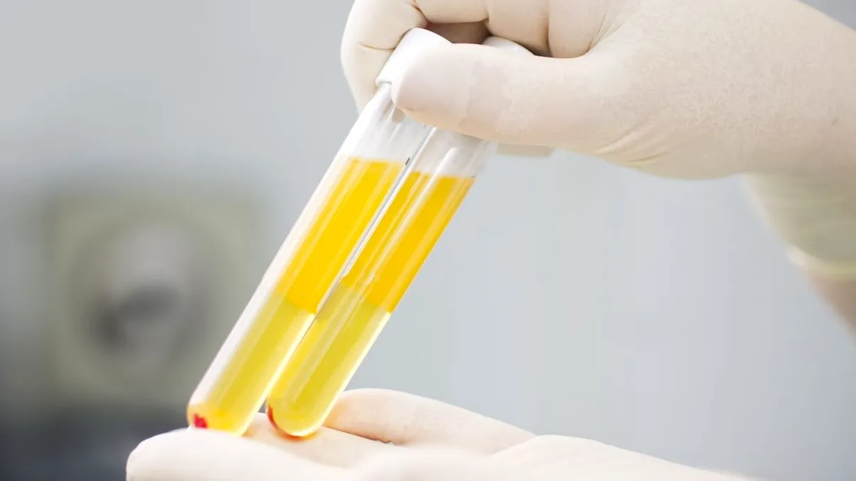 Un dispozitiv revoluționar permite extragerea plasmei fără consum de energie: La ce ajută, conform cercetătorilor