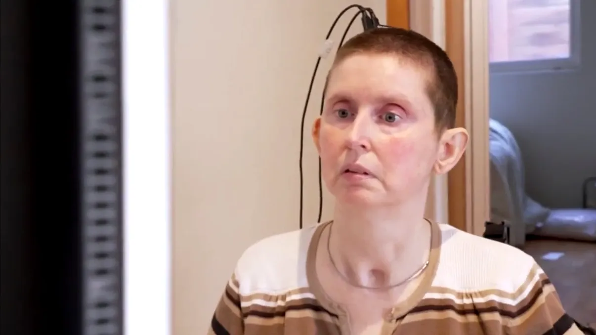 VIDEO: Femeie mută de 18 ani vorbește din nou cu ajutorul unui implant cu cip în creier