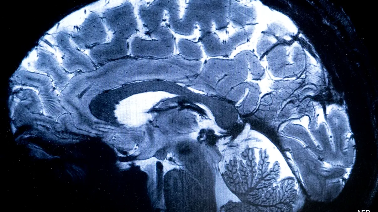 O nouă frontieră în imagistica cerebrală: Cercetătorii au reușit să trimită lumină prin întregul cap uman