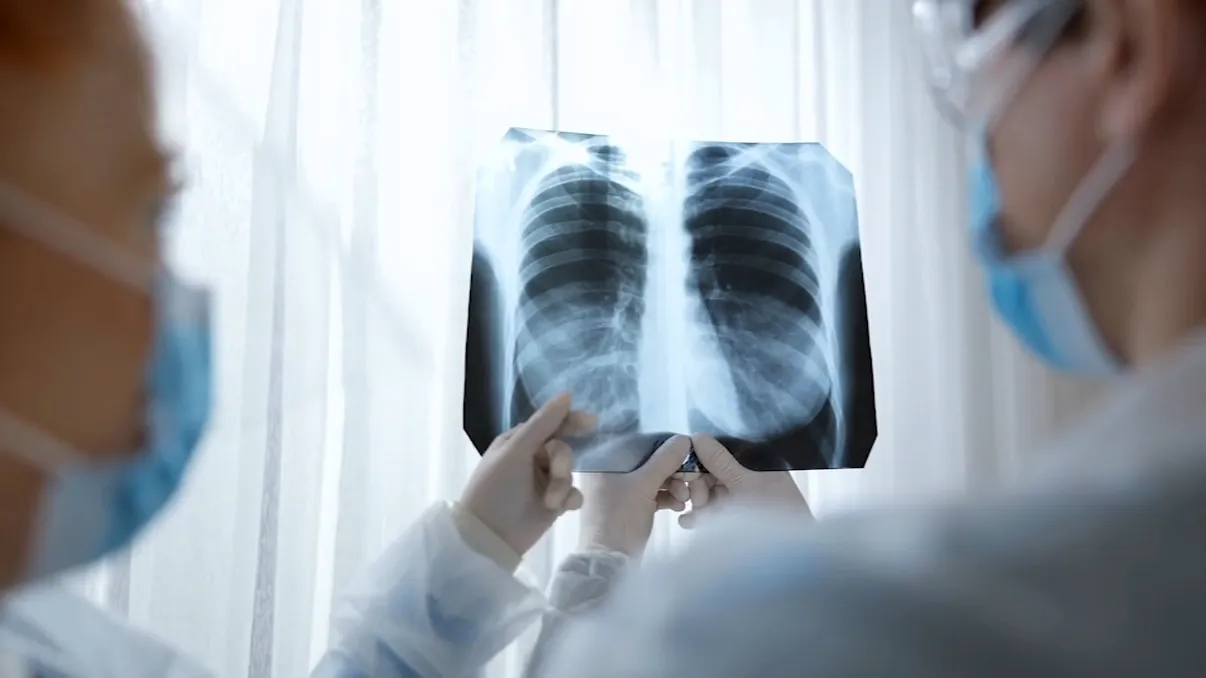 Tot mai mulți nefumători fac cancer pulmonar: o amenințare ignorată a epocii poluării. Ce spun oamenii de știință