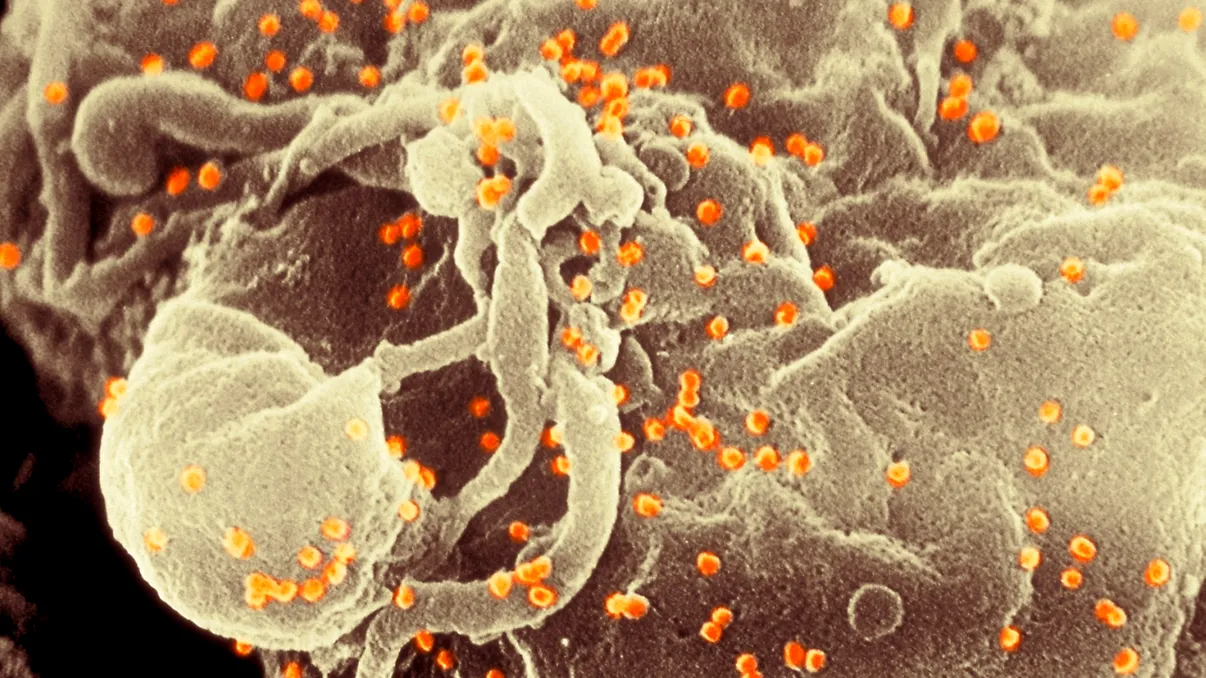 HIV ar fi putut schimba ADN-ul uman: cum au oprit tratamentele moderne evoluția forțată a sistemului imunitar