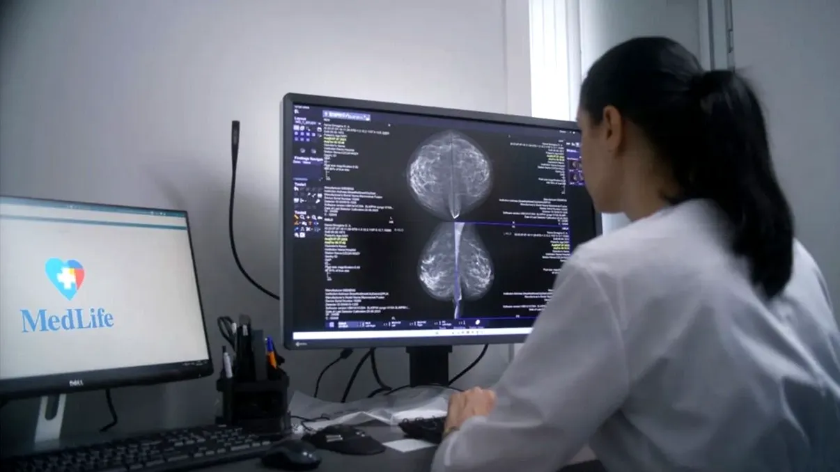 Accidentele vasculare cerebrale pot fi prevenite. Neurolog: “60-70% dintre cazuri au la bază cauze controlabile legate de mediul şi stilul de viaţă”
