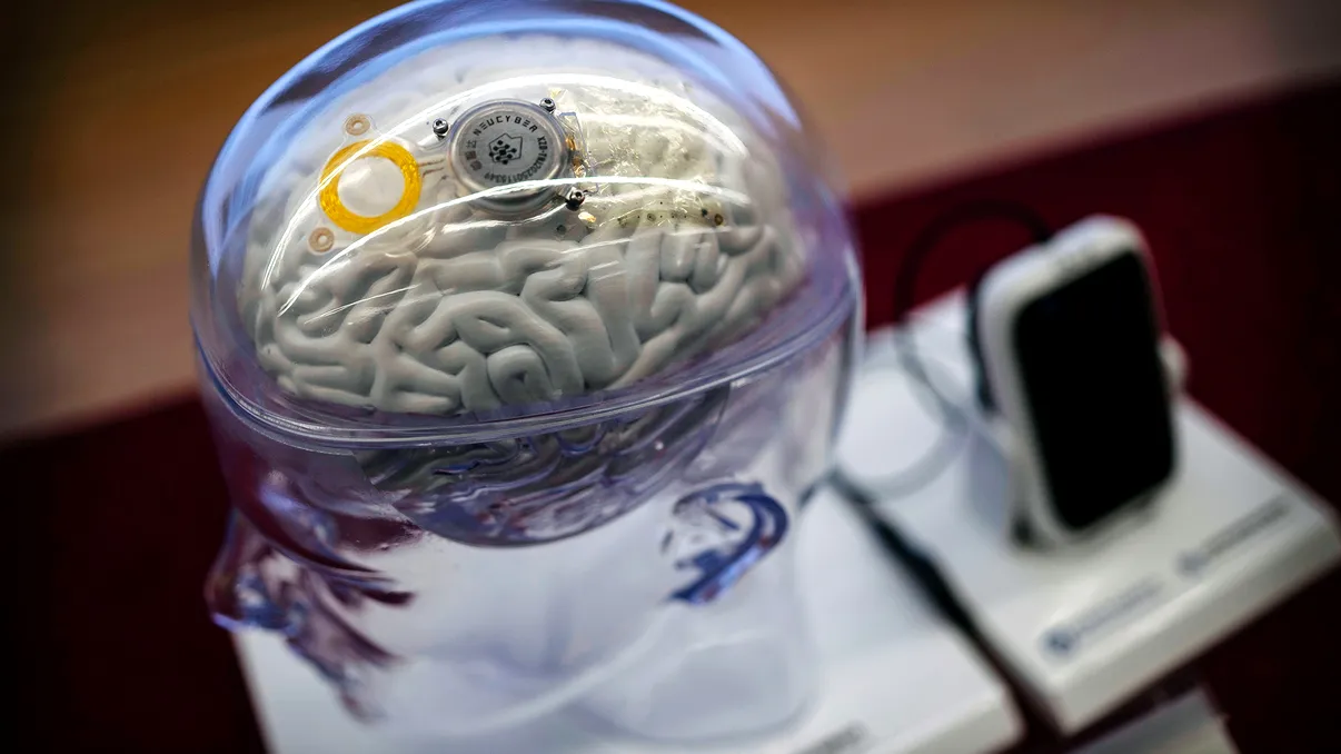 China o ia înaintea lui Elon Musk în cursa cipurilor pe creier. Primul implant cerebral aprobat comercial îi ajută pe pacienții paralizați să-și miște mâna