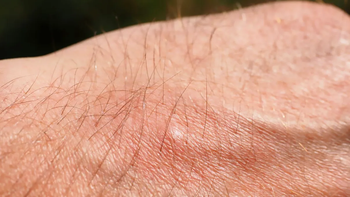 VIDEO Medicii i-au uitat o copcă în picior și s-a chinuit trei ani: cum a reușit să o scoată