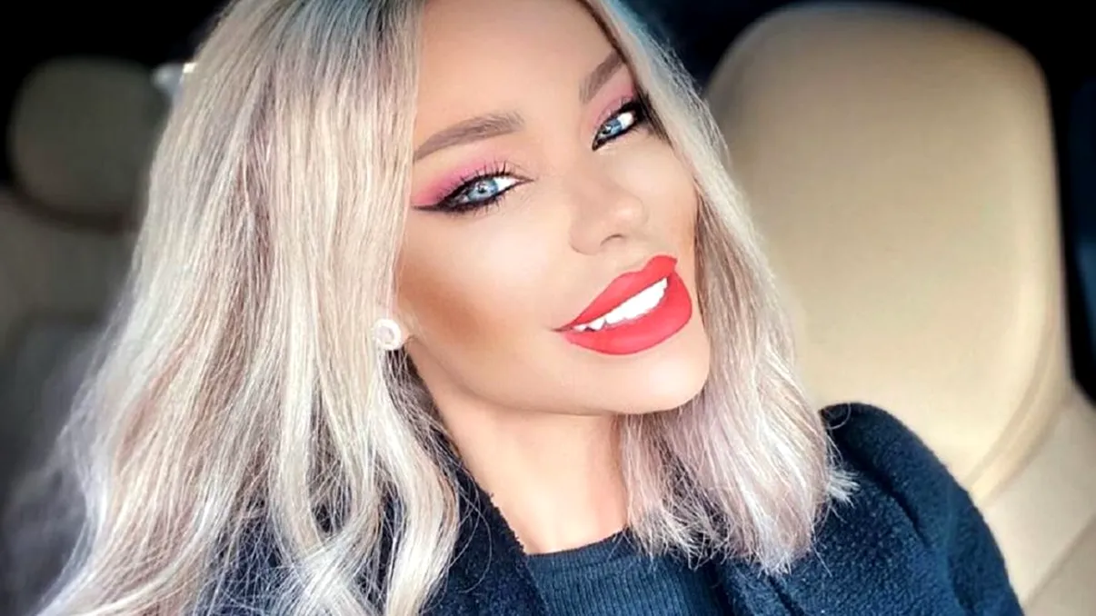 Operația la care Bianca Drăgușanu trebuie să recurgă urgent. Ce i-a spus medicul la ultimul control