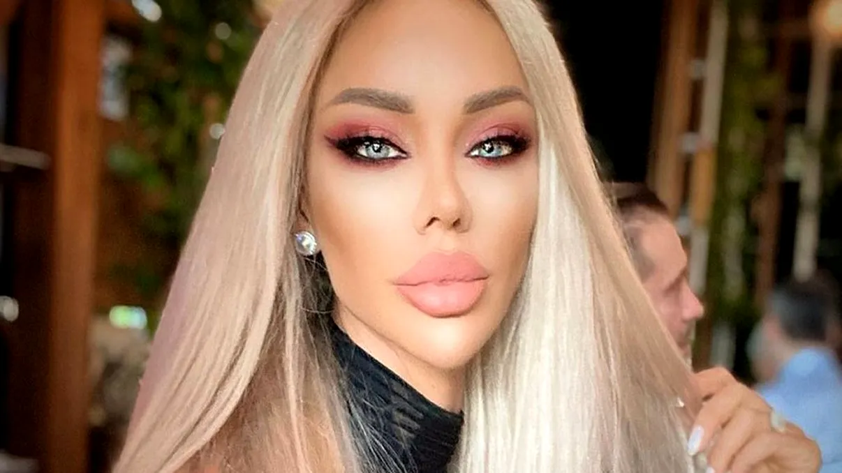 Cum arată Bianca Drăgușanu, după ce s-a operat pentru a noua oară. Lumea de pe stradă s-a uitat lung