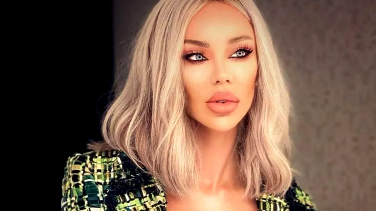 Bianca Drăgușanu, o nouă operație estetică. Nici nu voia să audă de așa ceva, dar iată cum arată acum