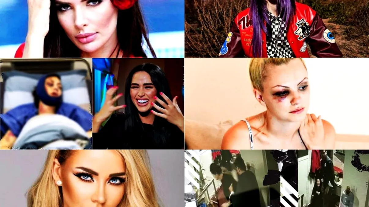 Top 8 vedete din România bătute de iubiții lor. Scene dramatice cu celebritățile arse cu țigara sau lovite cu bestialitate