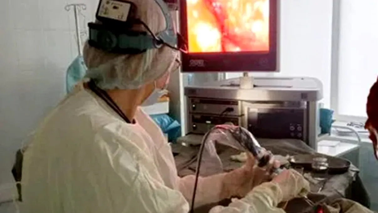 Ireal! Ce au scos medicii din nasul unui bărbat. A trăit 50 de ani cu obiectul acolo