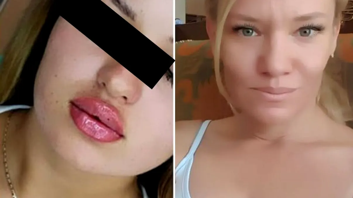 Medic estetician fals, prins de poliție. Ce proceduri ilegale făcea și câte sute de euro cerea