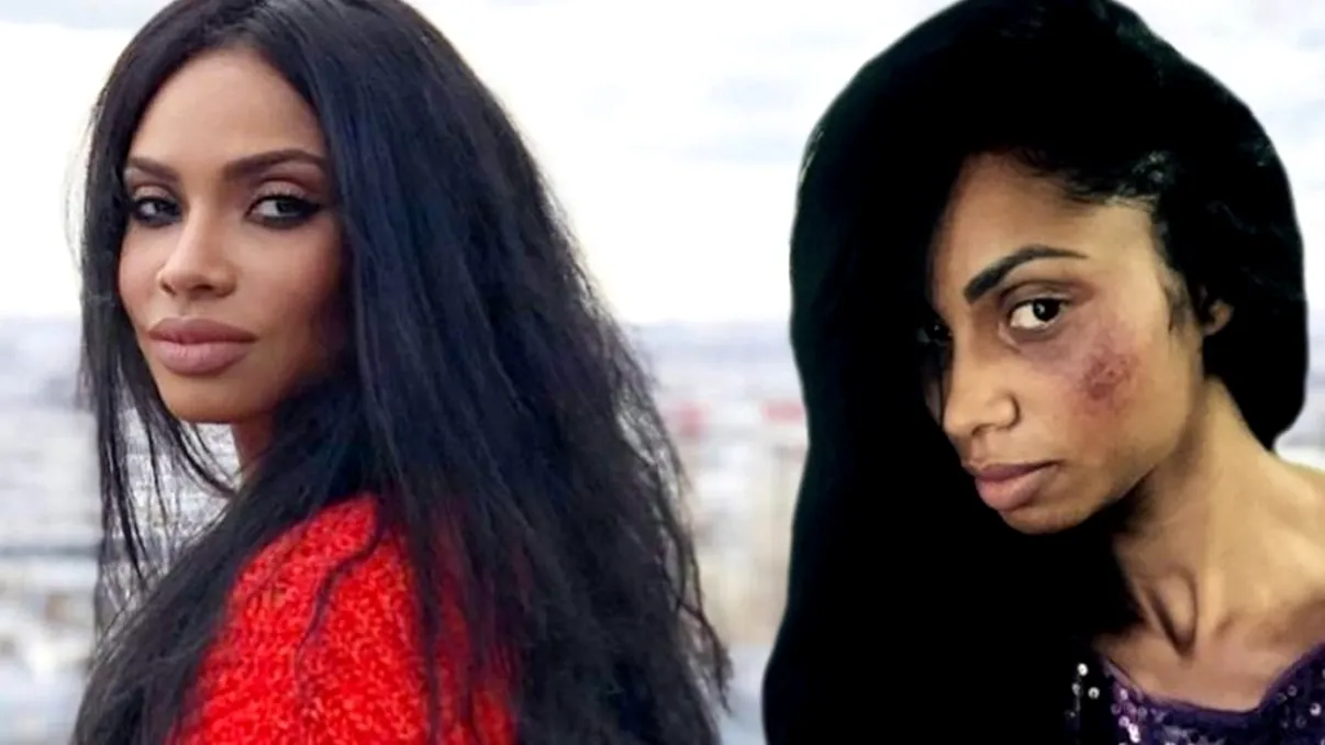 EXCLUSIV Răsturnare de situație în cazul lui Laurette. Ce legătură este între ea și bărbatul care a bătut-o