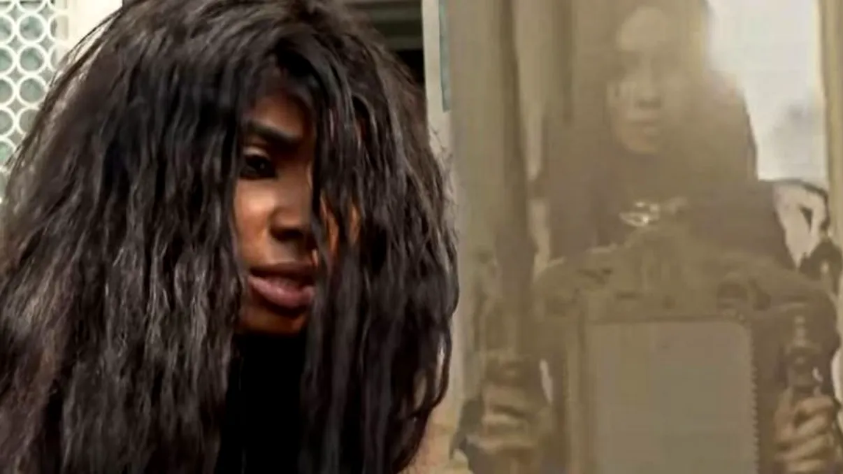 Imagini tulburătoare cu rănile lui Laurette. Cum arată după bătaia primită