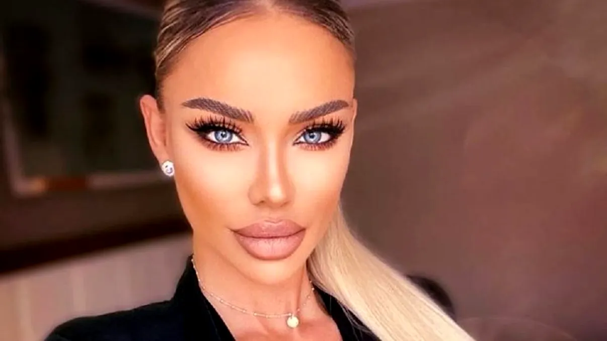 Ce probleme are Bianca Drăgușanu după operația la nas. A trecut o lună și încă suferă